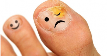 9 maneiras caseira e eficazes para se livrar do fungo das unhas unhas dos pés com fungos