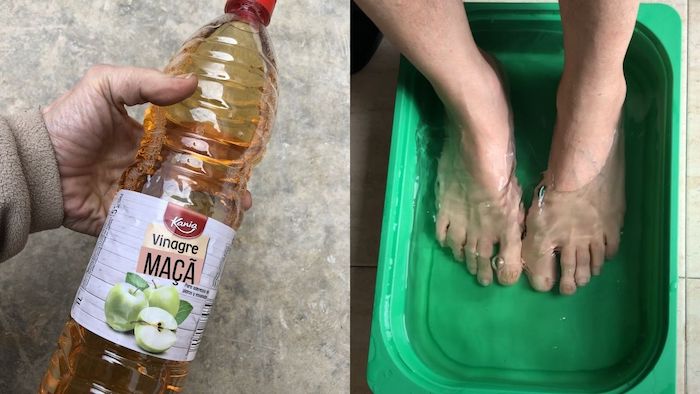 Coloque Seus Pés em Vinagre de Maçã e Veja a Transformação